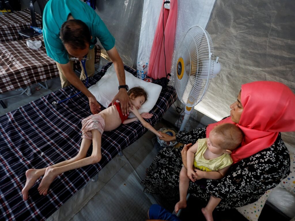 At least 66 children dead of malnutrition in Gaza as Israel tightens siege | Israel-Iran conflict News