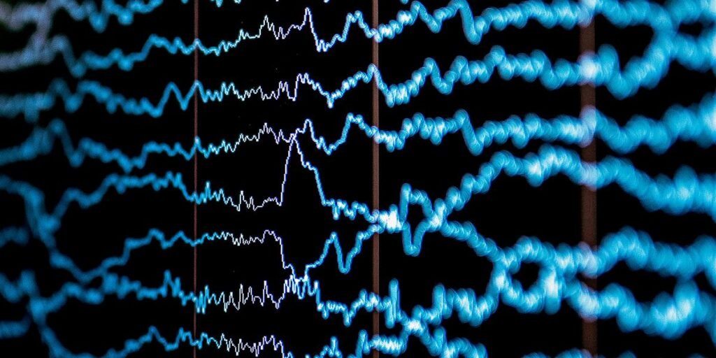 Tech Shares Pain Perception Measured by Brain Waves