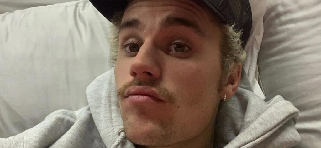 Justin Bieber Suffers Painful Rib Injury After Onewheel Skateboard Accident