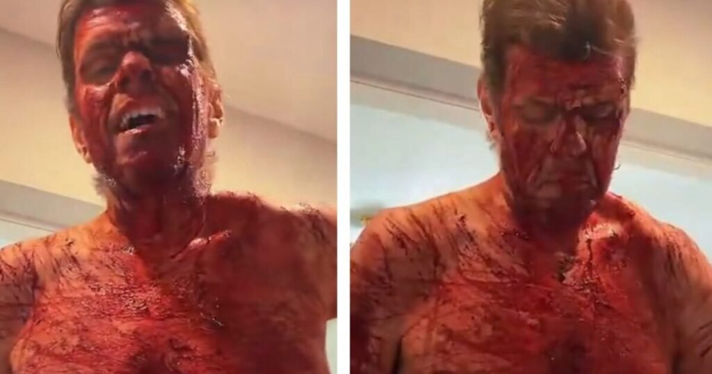 Celebrity Blogger Perez Hilton Self-Harms on TikTok Livestream – Fully Nude, Covered in Blood – Taken Away by Ambulance * The Gateway Pundit * by Cristina Laila